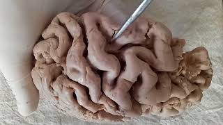 NEUROANATOMY  CEREBRAL CORTEX PART1 SULCI AND GYRI  BY DR MITESH DAVE [upl. by Lyred440]