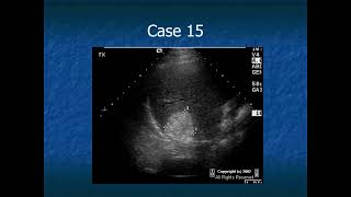 RADIOLOGY EXAM CASES [upl. by Brownson]