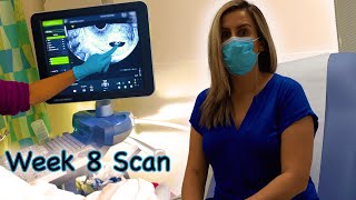 8 Week Scan amp no heartbeat  What to expect with Silentmissed miscarriage amp early symptoms Vlog 13 [upl. by Athelstan]