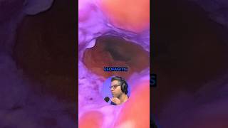 Esofagitis Endoscopia Esofago CesarTrochez DrCesarTrochez Gastro Medicina medico [upl. by Anetsirhc]