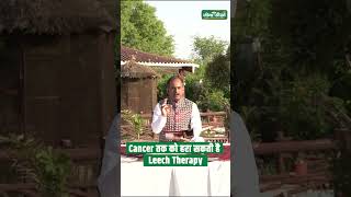 What is leech therapy  Leech therapy for Cancer  Leech therapy for pain relief  Acharya Manish ji [upl. by Ploss476]