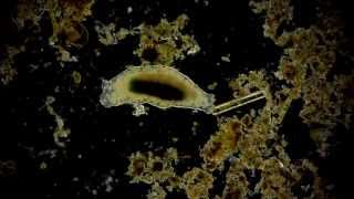 🔬 Bärtierchen  Tardigrada  Tardigrade  waterbears  moss piglets microorganism under microscope [upl. by Gnurt]