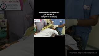 GENERAL ANAESTHESIA IN SURGERY ANAESTHESIA FOR RHINOPLASTY AND BREAST SURGERYZENITH CLINIC INDIA [upl. by Apostles]