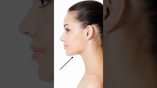 Double Chin Injections like Kybella®  What You Need to Know doublechin [upl. by Andrea]