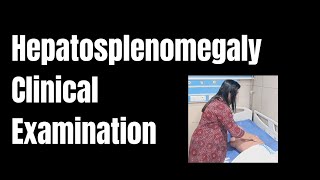 Hepatosplenomegaly Clinical Examination by Dr Merlin M Associate ProfessorDept of General Medicine [upl. by Cinnamon538]