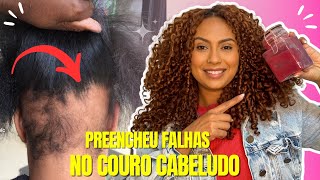 O CABELO CRESCE COMO LOUCO E NÃO CAI 😱 A MELHOR RECEITA DO MUNDO PARA CRESCER CABELO 😍 [upl. by Llertnad]