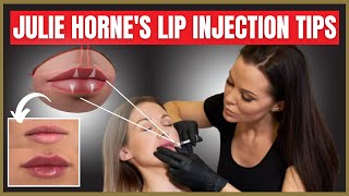 Julie Hornes Lip Injection Tips  Treating M Shaped Lips  Preventing Lumps [upl. by Hinman]