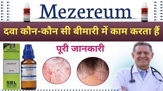 Mezereum 30  Mezereum 200  Mezereum Homoeopathic Medicine Uses In Hindi [upl. by Milah]