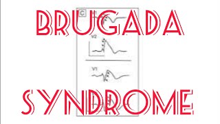 Brugada syndrome  Channelopathy including Short and long QT  Short qt [upl. by Akinod]