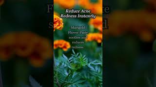 quotInstant Acne Redness Relief 🌼 Marigold Flower Soothing Paste AcneCare NaturalSkinCalm BlissVeda [upl. by Toy]