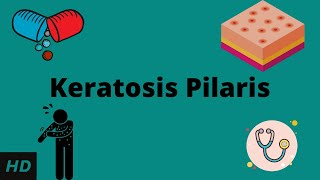 Keratosis Pilaris Causes Signs and Symptoms Diagnosis and Treatment [upl. by Siuqcram]