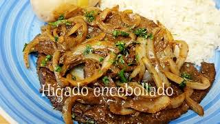 HÍGADO ENCEBOLLADO [upl. by Hessler]