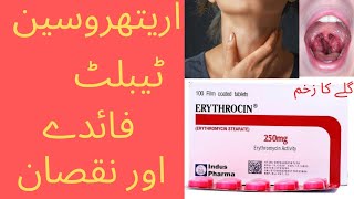 Erythrocin tablet benefits in urdu  galy kay zakham ka ilaj  erethrocine tablet ky faiday tronsil [upl. by Maclean254]