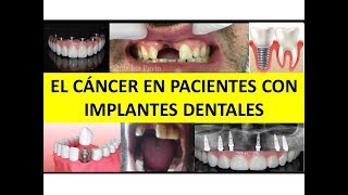 quotEL CÁNCER EN PACIENTES PORTADORES DE IMPLANTES DENTALESquot por la Dra Ana Miranda [upl. by Elamaj154]