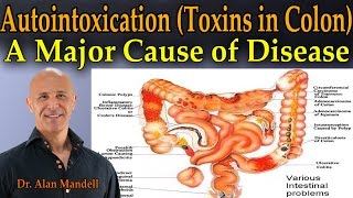 Autointoxication Toxins in the Colon  A Major Cause of Pain Sickness and Disease  Dr Mandell [upl. by Aynosal834]