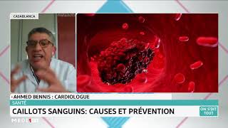 Quels sont les causes de la formation des caillots sanguins [upl. by Carmelina]