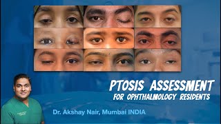 Ptosis Evaluation for Ophthalmology students  Residents and Fellows [upl. by Ahsenaj7]