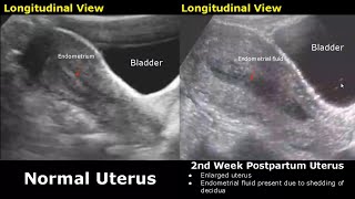 Gynecological amp Obstetric Ultrasound Normal Vs Abnormal Scan  Uterus Ovary Cervix Pregnancy USG [upl. by Adlemi]