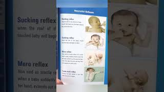 Neonatal reflexes viralvideo ministryofhealth publicawareness nursingstudent education [upl. by Ennadroj]