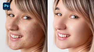 Retouch Skin in Seconds  Photoshop Tutorial  Skin Retouching [upl. by Clynes]