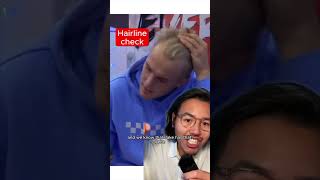 Jake Paul’s hair loss is being accelerated by his sport Balding amp hard training can go hand in hand [upl. by Kier995]