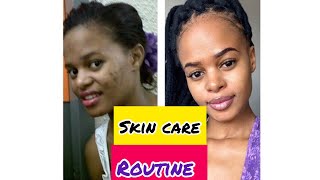 Skin Before amp After Skin Care Routine Shaz The Dietitian [upl. by Anilac]