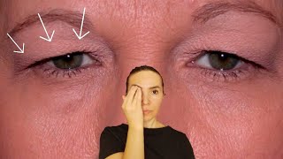 Fix droopy eyelids  How to tighten droopy eyelids [upl. by Marlea]