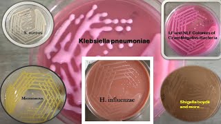 Colony characteristics of Staphylococcus Enterococcus E coli Klebsiella MicrococcusSalmonella [upl. by Eceinhoj709]