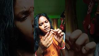 Sick hangnails 😳🥲 Full Version shorts viral [upl. by Perlis]