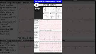 Ischemic Heart Disease 3 Myocardial Infarction STEMI amp NSTEMI [upl. by Nnylatsyrk946]