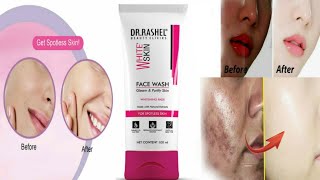 winter face wash  dr rashel skin whitening face wash effectsskin brightening face wash [upl. by Illyes]