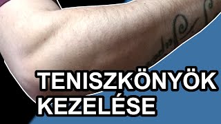 A teniszkönyök kezelése  Fábián gyógytorna [upl. by Margy]