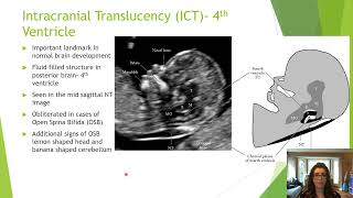 Beyond the ‘Nuchal’ Getting the Most from the 1114 Week Ultrasound  Michelle Sutherland  AFIC [upl. by Rebmyk]