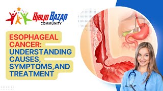 🩺 Understanding Esophageal Cancer Symptoms Treatment and Care 🩺 [upl. by Edrei]