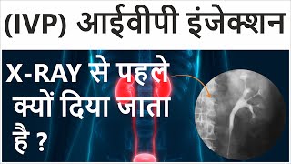 Intravenous Pyelogram in Hindi  Intravenous Pyelogram Procedure  IVP Test for Kidney [upl. by Nally]