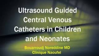 Ultrasound Guided Central Venous Catheters in Children and Neonates [upl. by Yreneh931]