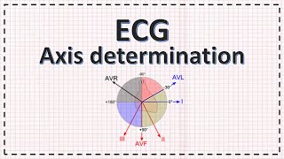 Cardiac Axis Determination  ECG Axis  Simplified [upl. by Acimahs]