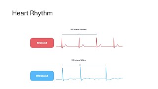 Sinus Rhythm Regular rhythm Irregular Rhythm [upl. by Ainevul189]