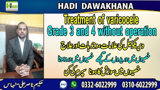 Varicocele treatment without surgery  Varicocele kya hai  Varicocele treatment medicines [upl. by Novla]