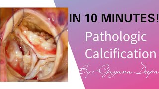 Pathological Calcification in 10 Minutes [upl. by Busby551]