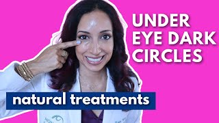 Eye Doctor Explains How To Get Rid Of Dark Under Eye Circles Naturally [upl. by Anec]