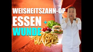 WeisheitszahnOP WUNDE kann ESSEN einwachsen [upl. by Carrol]