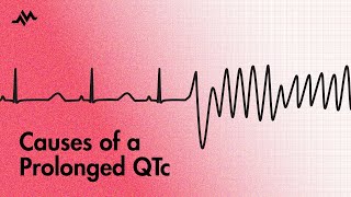 Causes of a prolonged QT interval [upl. by Brooke646]