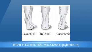 Foot Pronation And Supination  What Is The Difference [upl. by Nies926]