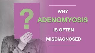 Adenomyosis Symptoms Why Adenomyosis Is Often Misdiagnosed And What to Do About It [upl. by Gnohc]