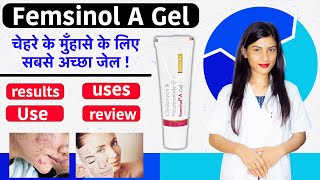 Femcinol a Gel Uses in Hindi  Femcinol a Gel how To Apply  Uses  Use  Side Effects [upl. by Maloy491]