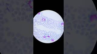 Babesia canis in dogs  Blood parasite [upl. by Yv]