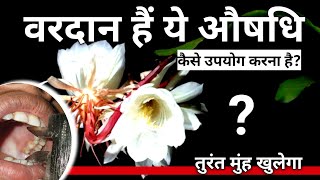 Oral Submucous Fibrosis Treatment With Ayurveda  Osmf Treatment In Hindi [upl. by Lerrad]