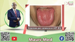 Hématologie  Carence en vitamine B12  Manifestations cliniques [upl. by Tynan]