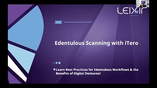 Preview Elevating Digital Impressions Edentulous Scanning with iTero [upl. by Urdna368]